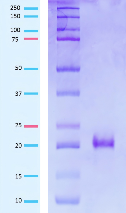 electrophoresis.png electrophoresis.png