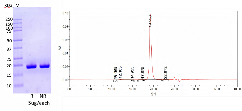 purity-analysis-of-il-2pro-by-sds-page-and-sec-hplc.png purity-analysis-of-il-2pro-by-sds-page-and-sec-hplc.png